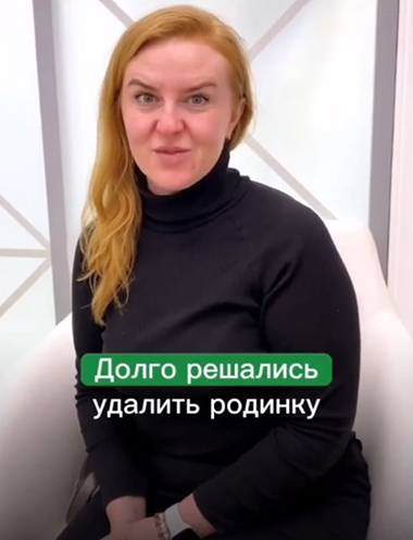 Удаления невуса